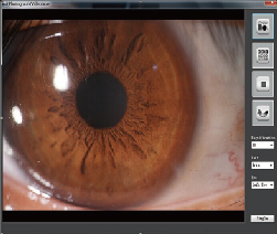 YZ5T  Slit Lamp Image System